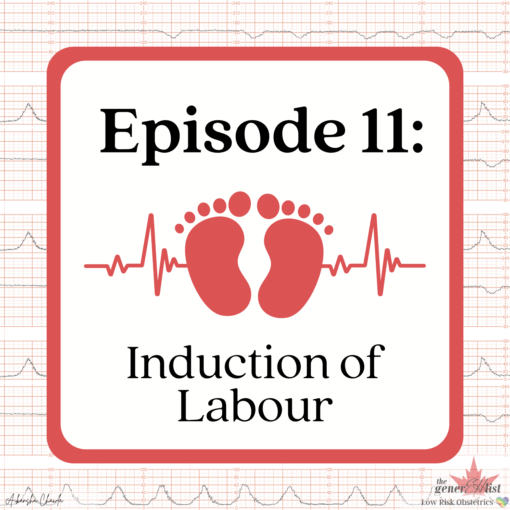 Episode 11 Induction Of Labour